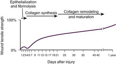 B9781455706068000343_f034-002-9781455706068